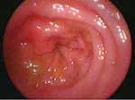 Gastrointestinal Endoscopy