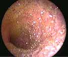 Gastrointestinal Endoscopy