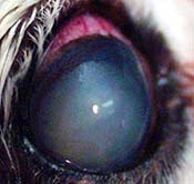 Anterior Lens Luxation