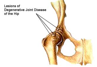 Anatomic Lesions Associated with Degenerative Joint Disease