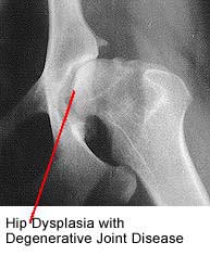Hip Dysplasia with Degenerative Joint Disease