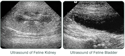 Ultrasound of the Kidney and Bladder