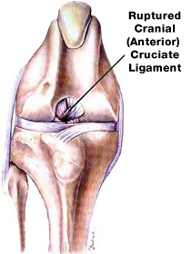 Knee Joint Showing Anterior (Cranial) Cruciate Ligament Rupture