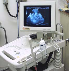 Veterinary Ultrasound Machine