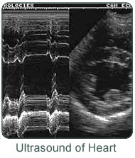 Ultrasound of the Heart